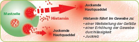 nesselsucht1